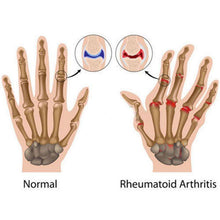 Copper Compression Arthritis Gloves Therapeutic Gloves for Men and Women, Support and Improve Motion Range